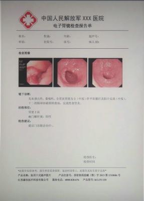 kg/jt-120医用干式胶片
