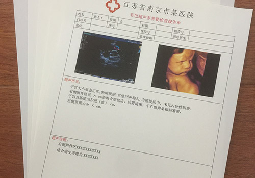 医用激光胶片  a4