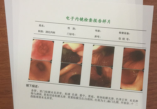 医用激光胶片  b5