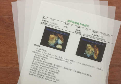 医用激光胶片a3