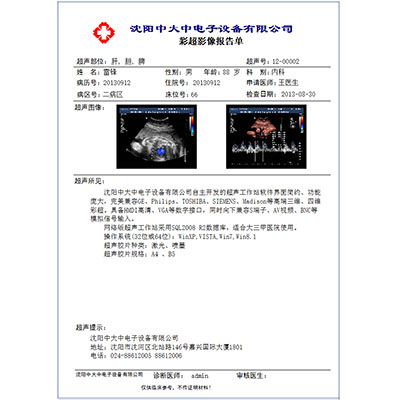 医用干式激光胶片11in×14in