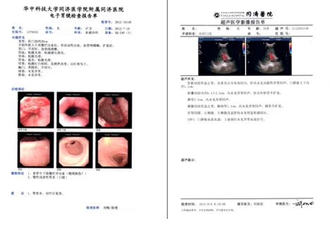 mha-pb5医用打印胶片