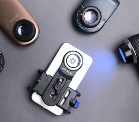 数字皮肤镜fotofinder bodystudio atbm