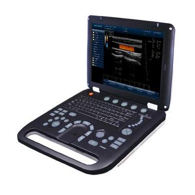 彩色超声诊断系统u101/u102/u103