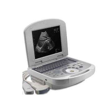 全数字超声诊断仪jh-3302