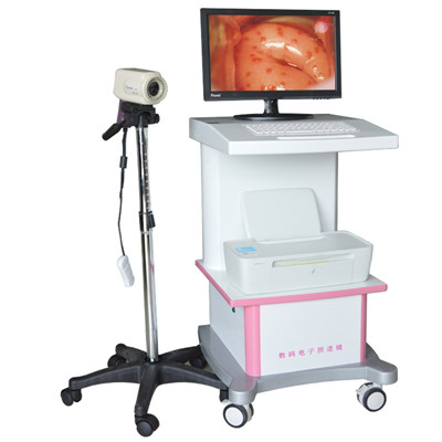 rh-220d型数码电子阴道镜