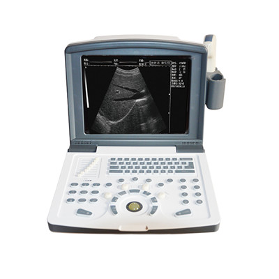 便携式b型超声诊断仪rh-300b