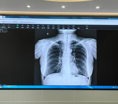 康泰医学影像工作站cms100