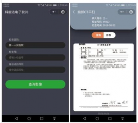 医用电子胶片软件med electronic film厂家