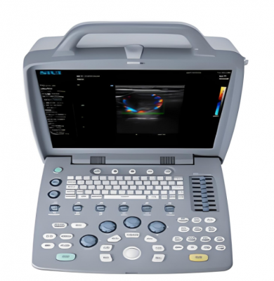 全数字彩色多普勒超声诊断系统apogee 1200厂家