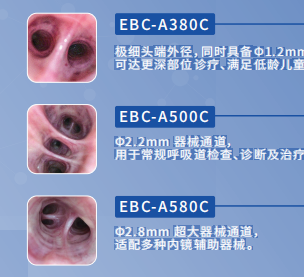 优亿一次性电子支气管镜ebc-a380c